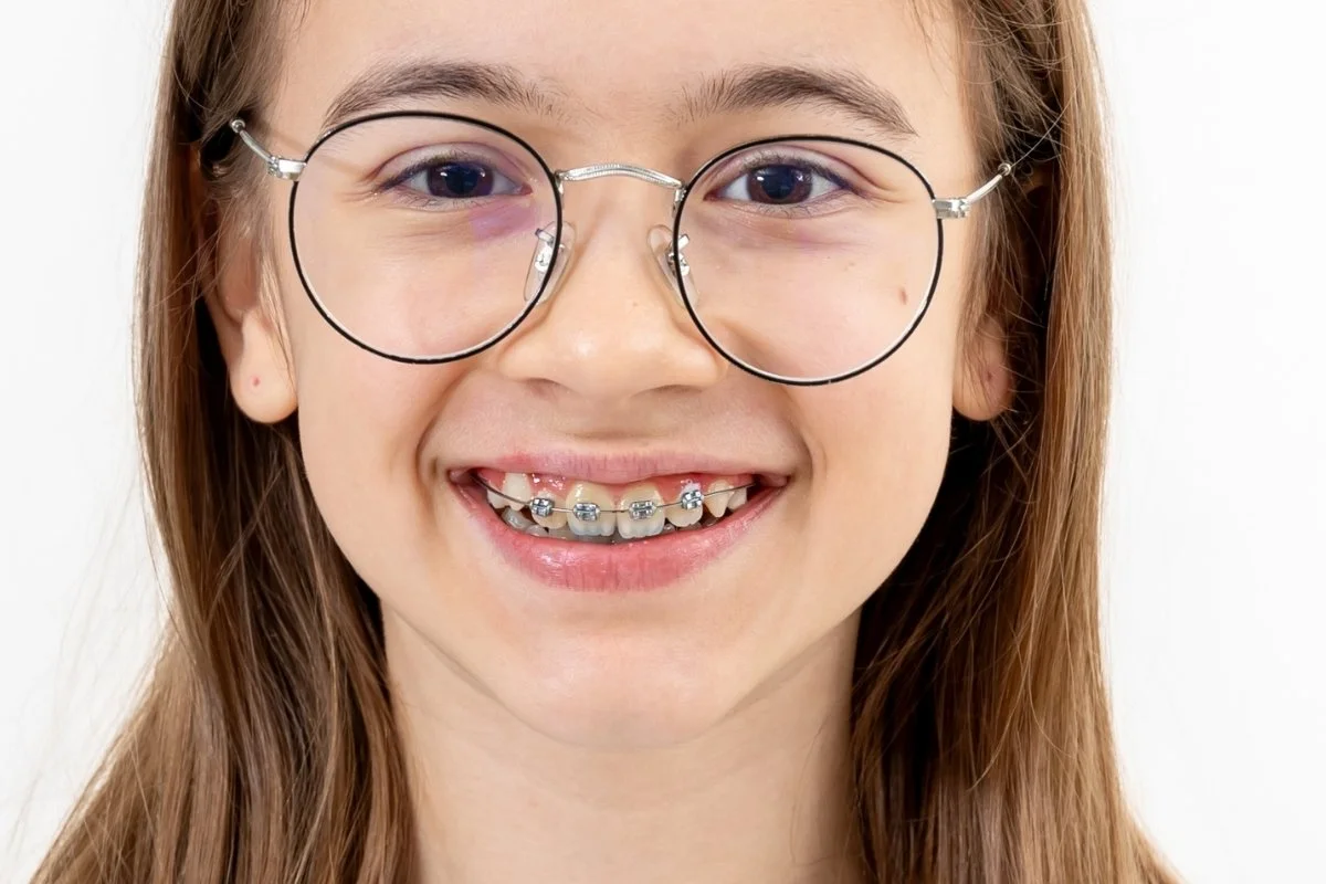 Ortodoncia infantil en Albacete