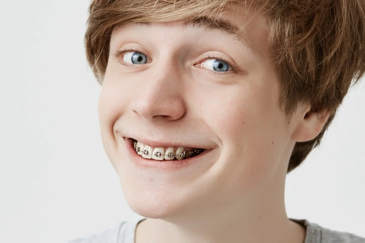 Ortodoncia para adolescentes en Albacete