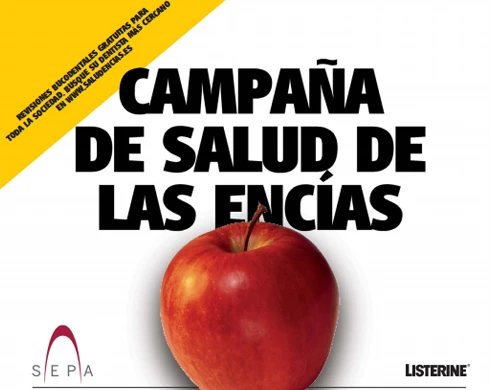 Dental UP revisa tus encías gratis