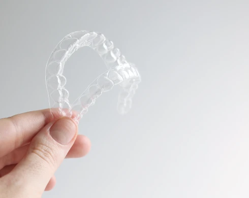 Invisalign, la nueva tendencia en ortodoncia