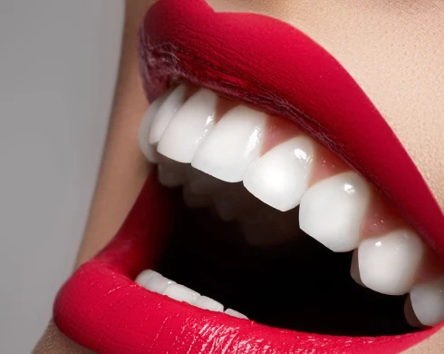 Luce tu sonrisa este verano