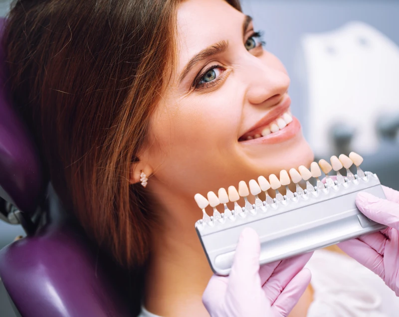 Carillas dentales en Dental UP, clínica dental en Albacete