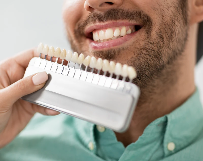 Paciente en selección de tono de carillas dentales en Dental UP, clínica dental en Albacete